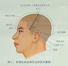  头针刺激区2 