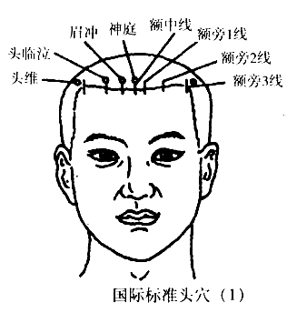 国际标准头穴