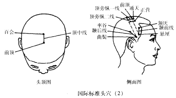 国际标准头穴
