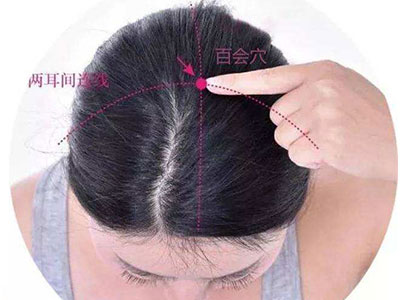 文章图片 百会
