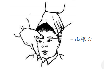 文章图片 山根穴