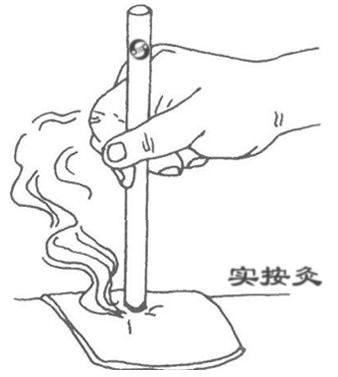 灸法之施灸方法分类